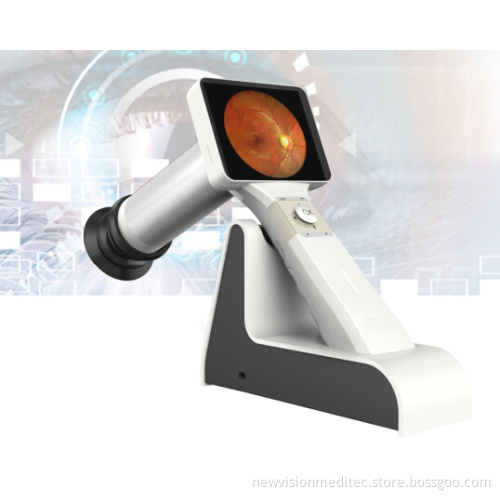Non Mydriatic Portable Digital Fundus Camera